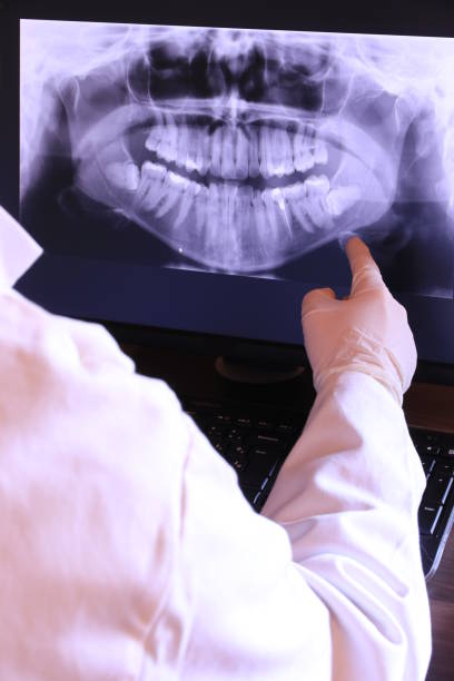 Best Emergency Wisdom Teeth Removal in Lakewood, CA